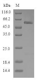 Recombinant Human Nicotinamide N-methyltransferase (NNMT)