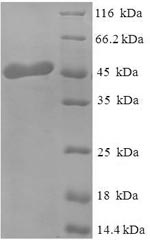 Recombinant Human Mimecan (OGN)