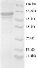 Recombinant Human UDP-N-acetylglucosamine--peptide N-acetylglucosaminyltransferase 110 kDa subunit (OGT), partial