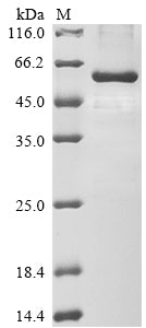 Recombinant Human Paired box protein Pax-6 (PAX6)