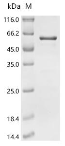Recombinant Human Paired box protein Pax-8 (PAX8)