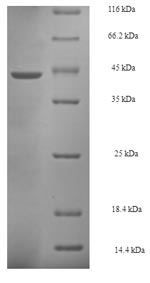 Recombinant Saccharomyces cerevisiae ProlifeRating cell nuclear antigen (POL30)