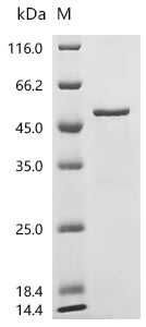Recombinant Human Choline-phosphate cytidylyltransferase A (PCYT1A)