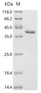 Recombinant Rat Phosducin (Pdc)