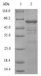 Recombinant Human PDZ and LIM domain protein 1 (PDLIM1)