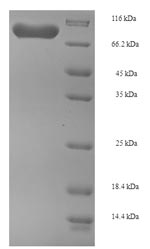 Recombinant Human Phosphoglucomutase-1 (PGM1)