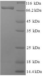 Recombinant Human Phosphoacetylglucosamine mutase (PGM3)