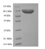 Recombinant Rat Pyruvate kinase isozymes R/L (Pklr)