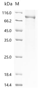 Recombinant Human DNA polymerase theta (POLQ), partial