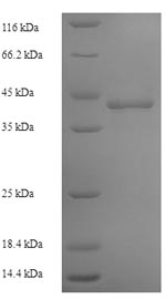 Recombinant Human DNA-directed RNA polymerase III subunit RPC1 (POLR3A), partial