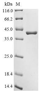 Recombinant Human Serine/threonine-protein phosphatase 2A catalytic subunit alpha isoform (PPP2CA)