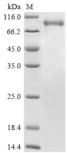 Recombinant Human Prolyl endopeptidase (PREP), partial