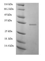 Recombinant Human 52KDA repressor of the inhibitor of the protein kinase (PRKRIR), partial