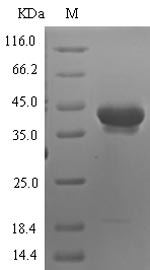 Recombinant Human Neurotrypsin (PRSS12), partial
