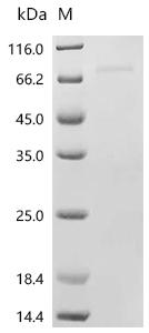 Recombinant Human Prostaglandin G/H synthase 1 (PTGS1)