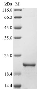 Recombinant Mouse Parvalbumin alpha (Pvalb)