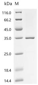 Recombinant Human Retinoblastoma-associated protein (RB1), partial