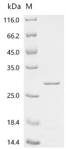 Recombinant Human Retinoblastoma-associated protein (RB1), partial