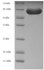 Recombinant Human Receptor-interacting serine/threonine-protein kinase 2 (RIPK2)