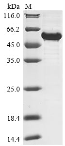 Recombinant Human Nuclear receptor ROR-alpha (RORA)