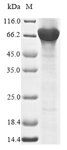 Recombinant Human Nuclear receptor ROR-gamma (RORC)