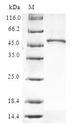 Recombinant Human 60S ribosomal protein L9 (RPL9)