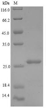 Recombinant Human Large ribosomal subunit protein P1 (RPLP1)
