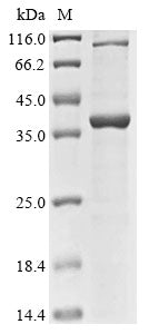 Recombinant Human Small ribosomal subunit protein eS4, Y isoform 1 (RPS4Y1)