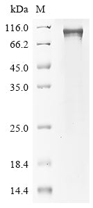 Recombinant Mouse Ribosomal protein S6 kinase alpha-4 (Rps6ka4)