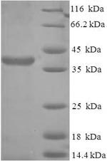 Recombinant Human Protein SCO2 homolog, mitochondrial (SCO2)