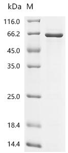 Recombinant Human Sestrin-2 (SESN2)