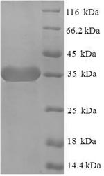Recombinant Human Signal-regulatory protein delta (SIRPD)