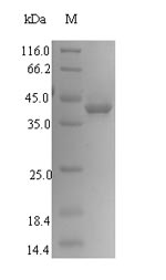 Recombinant Human Signal-regulatory protein gamma (SIRPG), partial