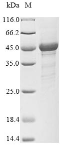 Recombinant Human S-phase kinase-associated protein 1 (SKP1)