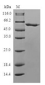 Recombinant Human Mitochondrial carnitine/acylcarnitine carrier protein (SLC25A20)