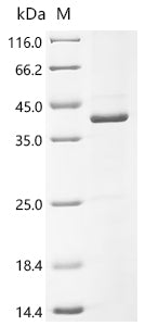 Recombinant Human Pendrin (SLC26A4), partial