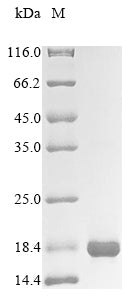 Recombinant Human Solute carrier family 2, facilitated glucose transporter member 1 (SLC2A1), partial