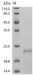 Recombinant Human Solute carrier organic anion transporter family member 1A2 (SLCO1A2),partial