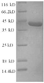 Recombinant Rat Alpha-synuclein (Snca)