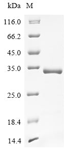 Recombinant Rat Superoxide dismutase [Cu-Zn] (Sod1)