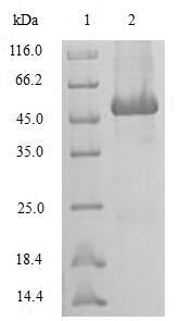 Recombinant Human Sorcin (SRI)