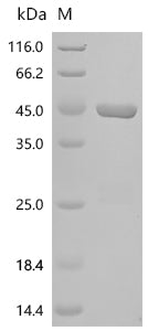 Recombinant Human Sorcin (SRI)