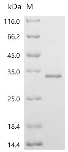 Recombinant Human StAR-related lipid transfer protein 6 (STARD6)