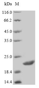 Recombinant Human Statherin (STATH)