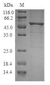 Recombinant Human Serine/threonine-protein kinase 16 (STK16)