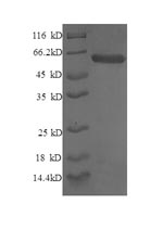 Recombinant Human Syntaxin-6 (STX6), partial