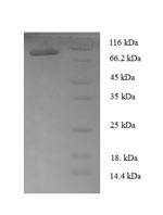 Recombinant Human T-box transcription factor TBX18 (TBX18)