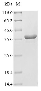 Recombinant Mouse Beta-tectorin (Tectb)