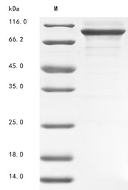 Recombinant Rat Serotransferrin (Tf)