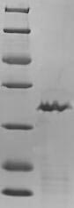 Recombinant Chicken Transforming growth factor beta-1 proprotein (TGFB1), partial